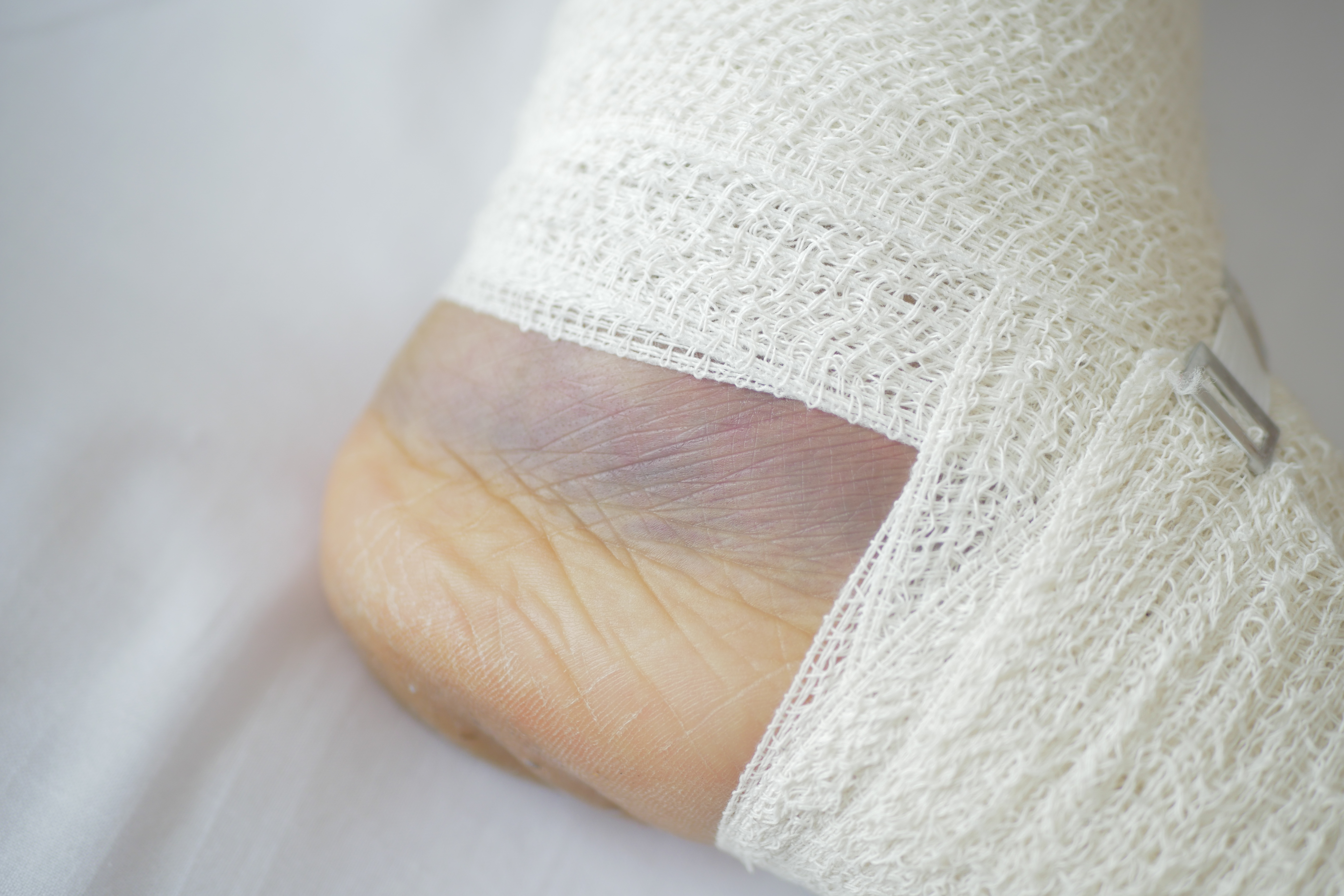 Woman with bandaged foot on bed
