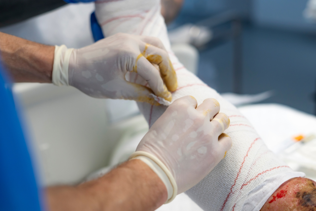 doctor looking at potential signs of an infection on a wound