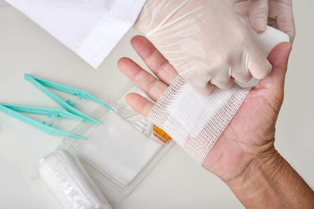 wound smells bad but no pus